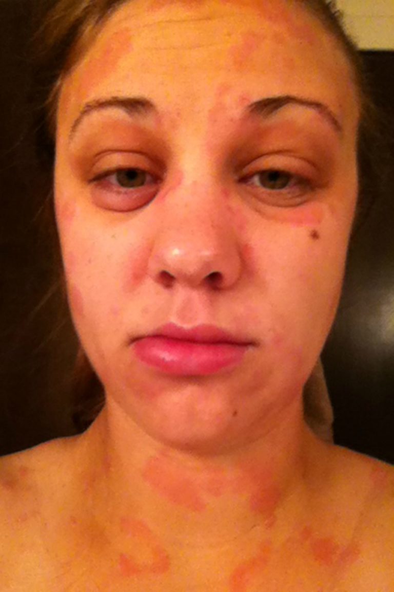 AIP Stories of Recovery – May 2015 - Autoimmune Wellness